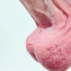 HeatSkin
